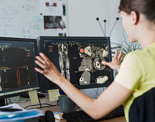 Medical advancement in Vienna A woman looking at two desktops, on which radiology scans are shown.
