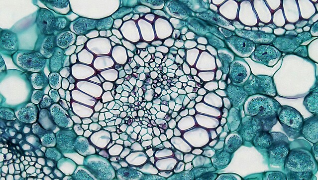 Microscope image of a human cell.